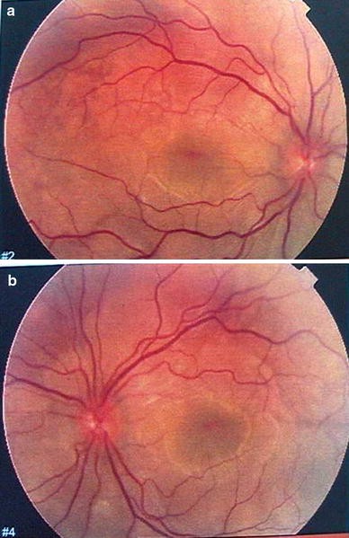 Fig. 1