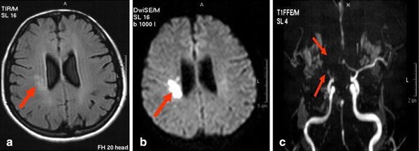 Fig. 1