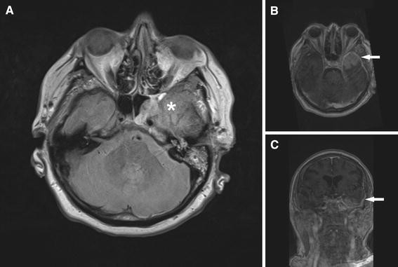 Fig. 1