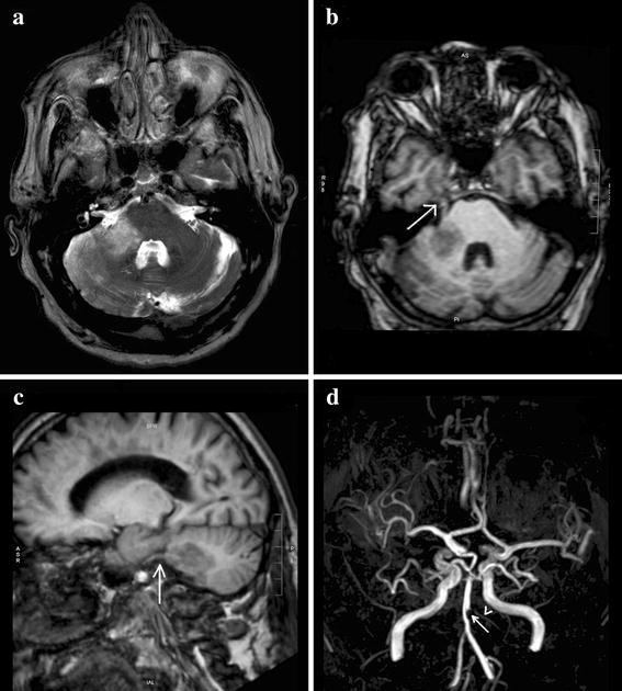 Fig. 1