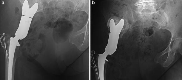 Fig. 1a–b