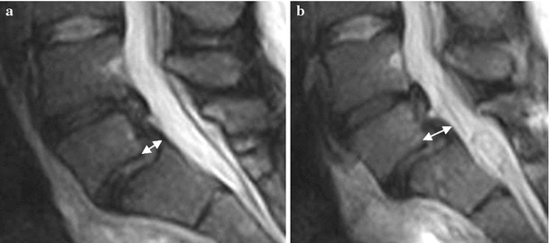 Fig. 10