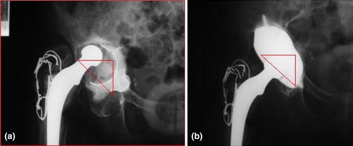 Fig. 2a–b