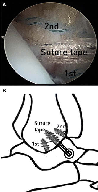 Fig. 2