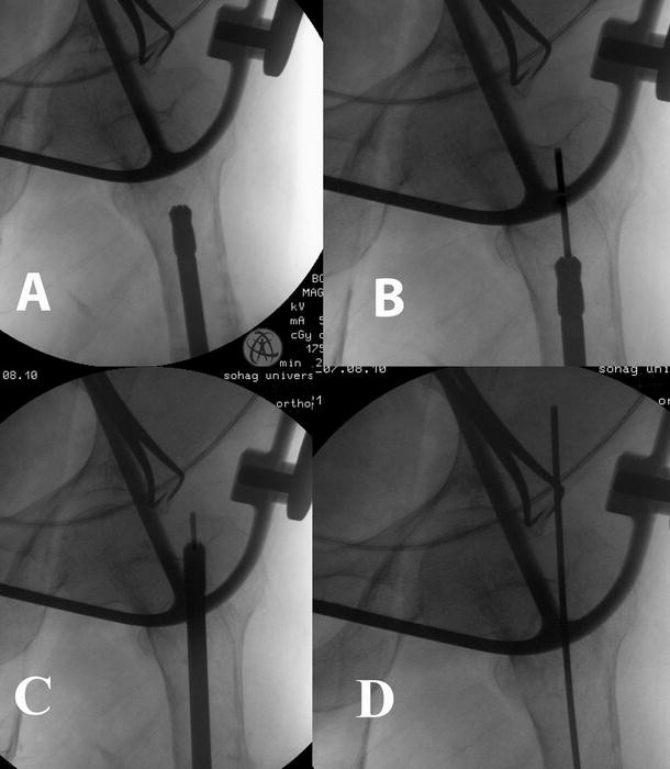 Fig. 1