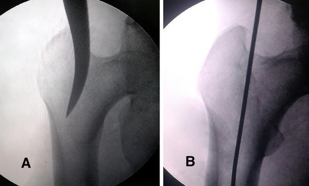 Fig. 2