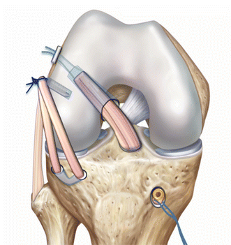 Fig. 7