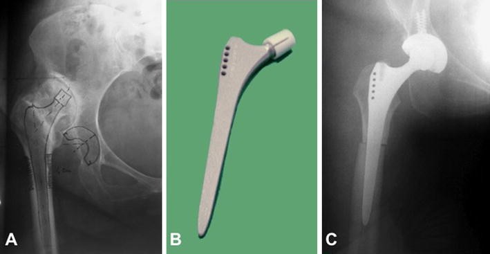 Fig. 2