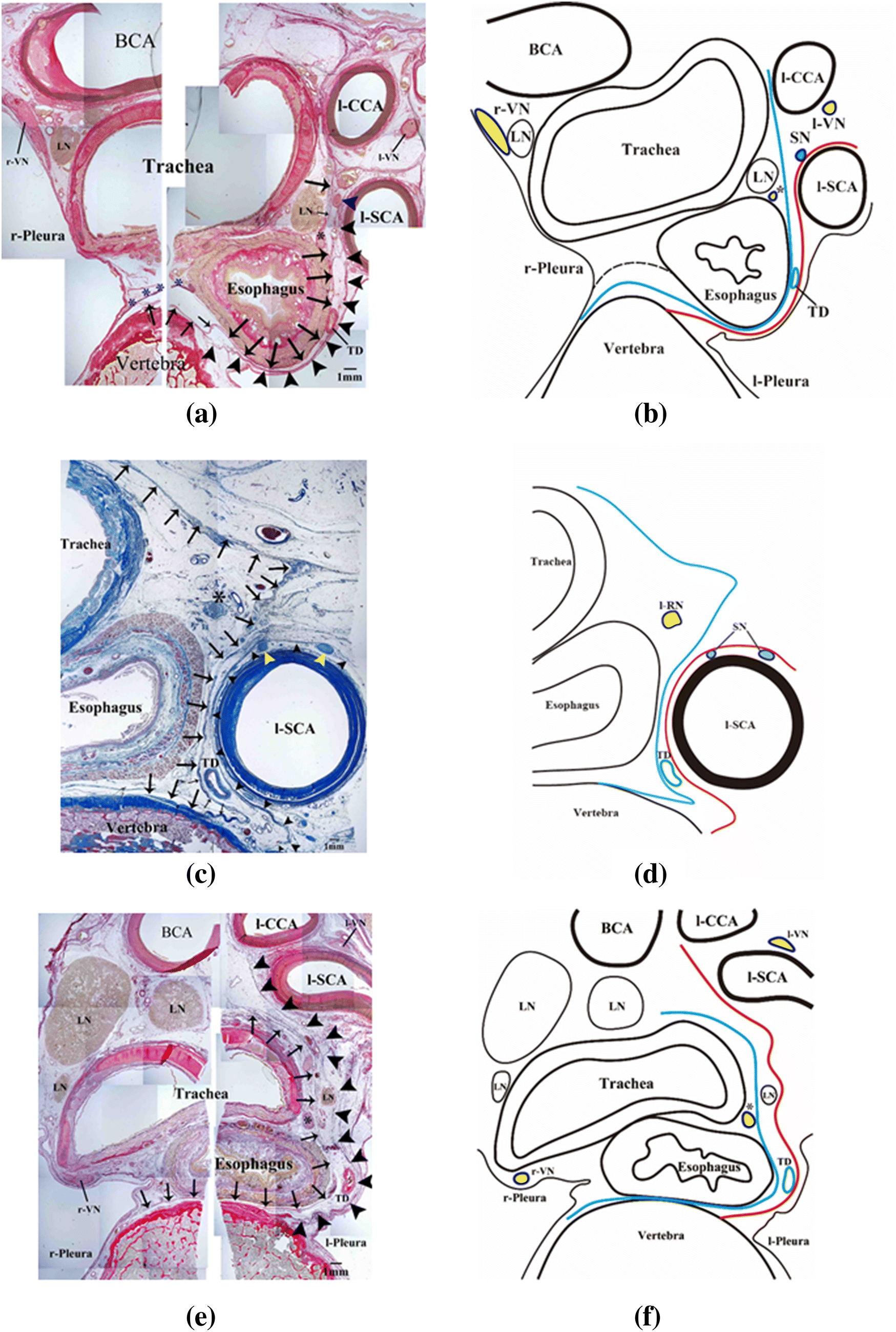 Figure 3 Histological Study Of The Thin Membranous Structure Made Of Dense Connective Tissue Around The Esophagus In The Upper Mediastinum Springerlink