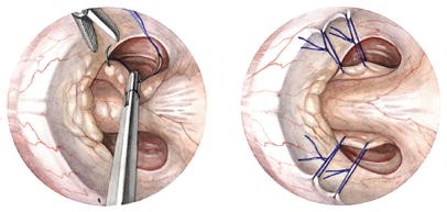 Fig. 6