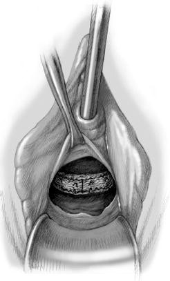 Fig. 15