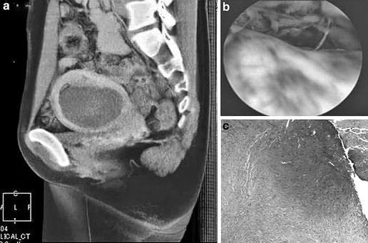 Fig. 2