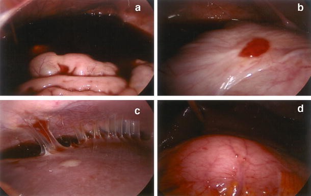 Fig. 1