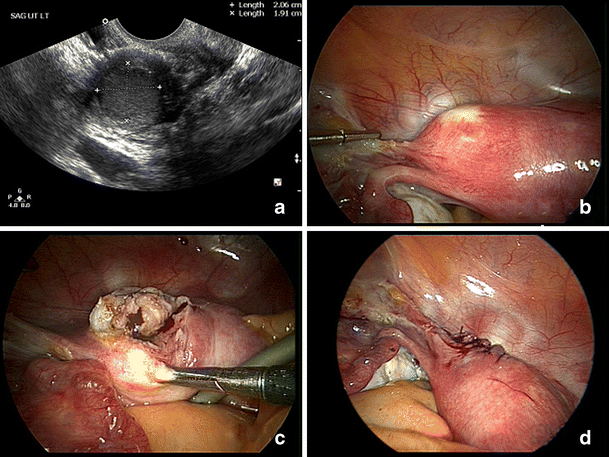 Fig. 1