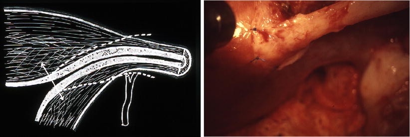 Fig. 29