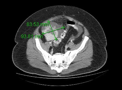 Fig. 1