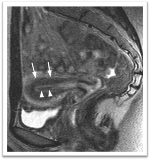 Fig. 11