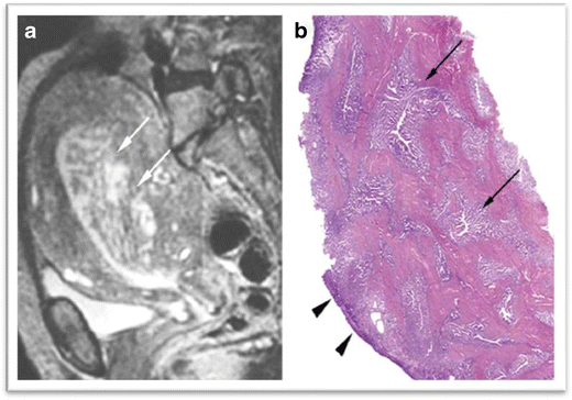 Fig. 13