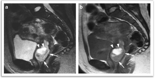 Fig. 15