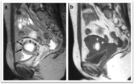 Fig. 16