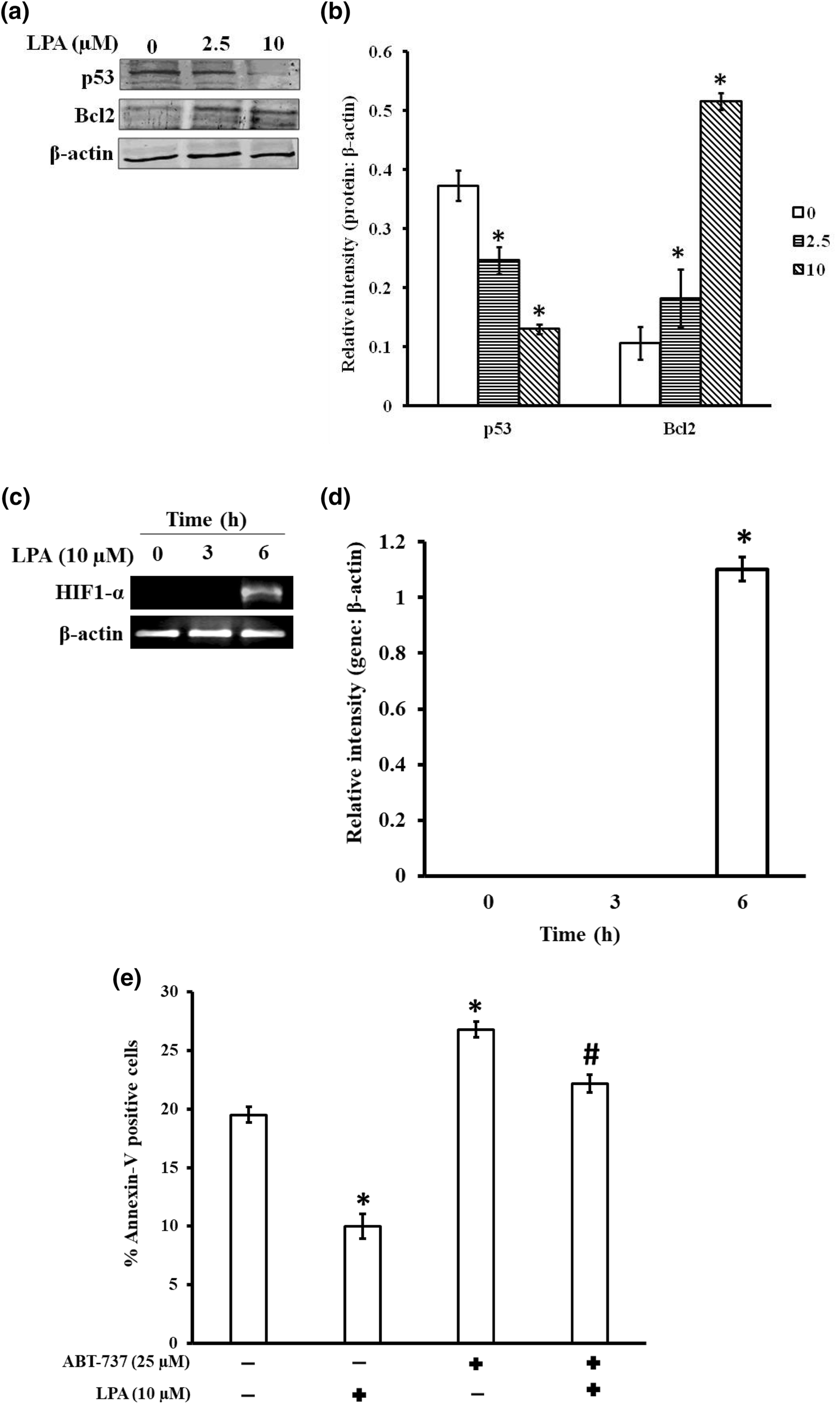 Figure 4 Lysophosphatidic Acid Promotes Survival Of T Lymphoma Cells By Altering Apoptosis And Glucose Metabolism Springerlink