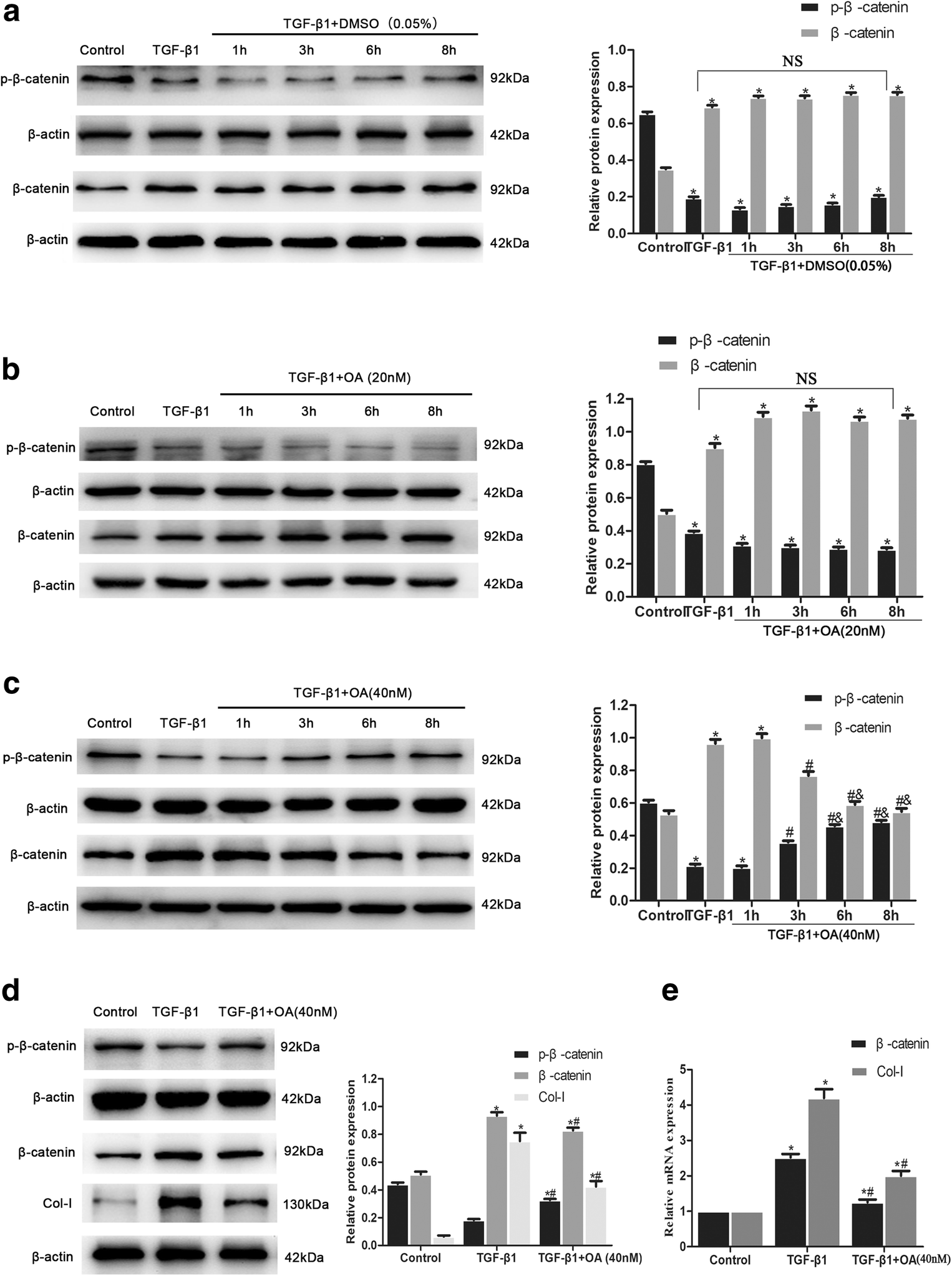 Figure 3 Protein Phosphatase 2a Inhibiting B Catenin Phosphorylation Contributes Critically To The Anti Renal Interstitial Fibrotic Effect Of Norcantharidin Springerlink