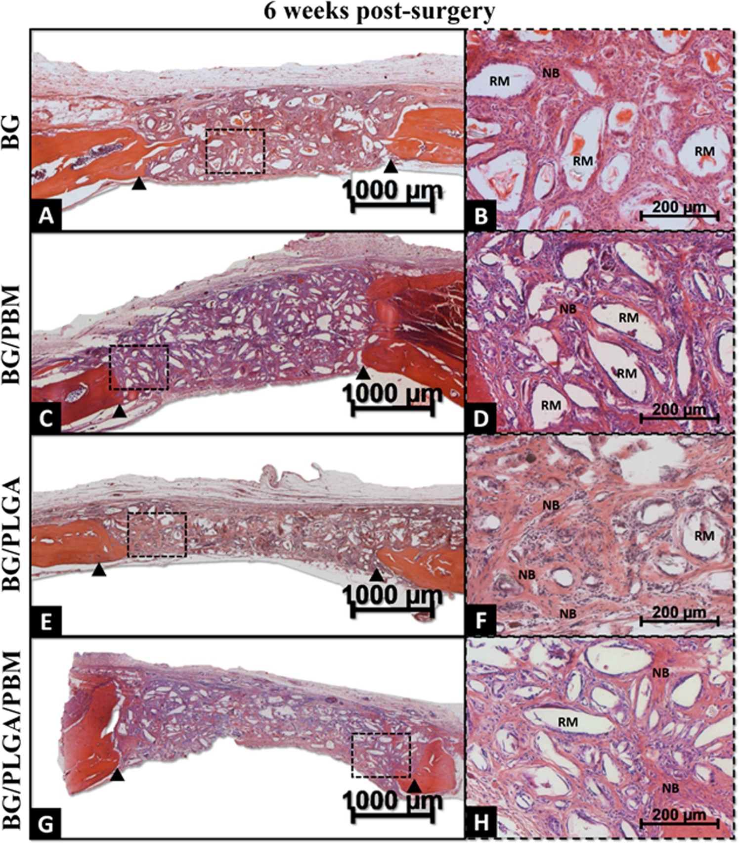 Figure 3 Bioglass Plga Associated To Photobiomodulation Effects On The Healing Process In An Experimental Model Of Calvarial Bone Defect Springerlink