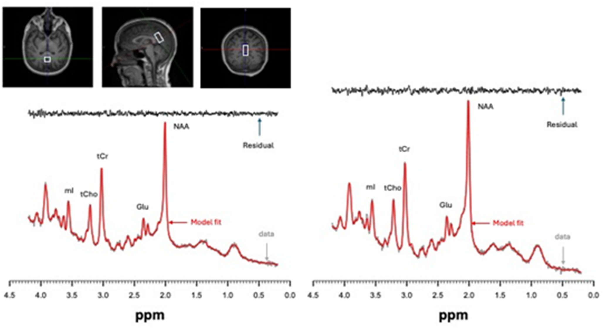 食事の変化が記憶や炎症に関係する脳マーカーに迅速に影響(Study Finds Dietary Changes Quickly Alter Brain Markers Linked to Memory and Inflammation)