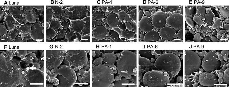 Figure 2 Overexpression Of Puroindoline A Gene In Transgenic Durum Wheat Triticum Turgidum Ssp Durum Leads To A Medium Hard Kernel Texture Springerlink Figure 2 Overexpression Of Puroindoline A Gene In Transgenic Durum Wheat Triticum Turgidum Ssp Durum Leads To A Medium Hard Kernel Texture Springerlink