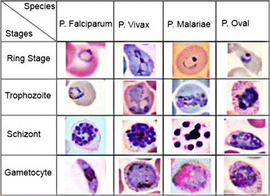 Figure 1 A Review On Automated Diagnosis Of Malaria Parasite In Microscopic Blood Smears Images Springerlink