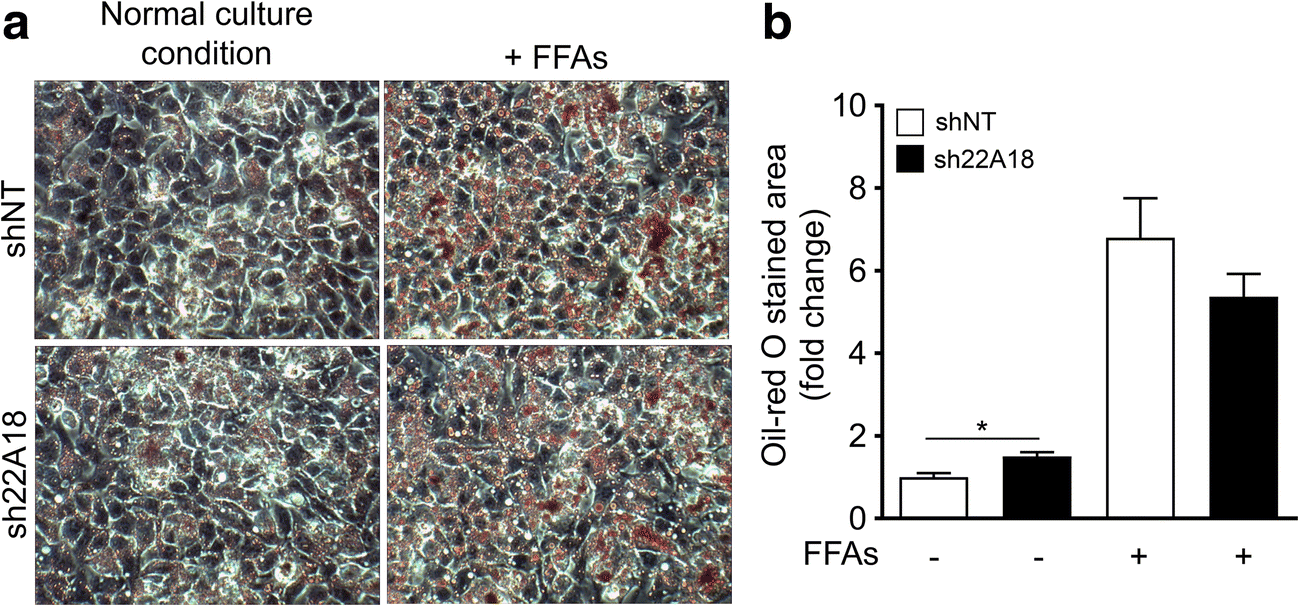 Figure 3 Knockdown Of Orphan Transporter Slc22a18 Impairs Lipid Metabolism And Increases Invasiveness Of Hepg2 Cells Springerlink