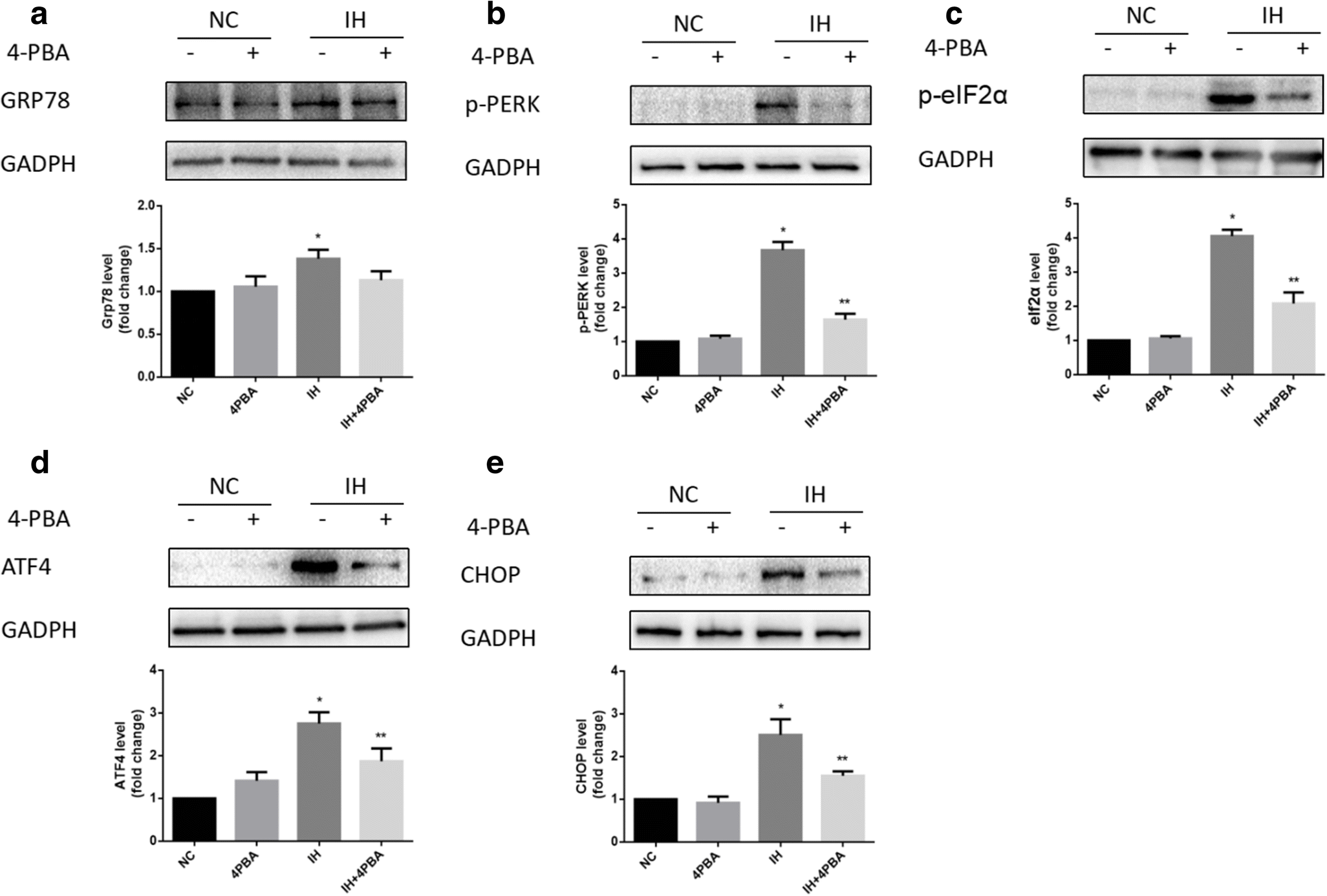 Figure 4 4 Phenylbutyric Acid Attenuates Endoplasmic Reticulum Stress Mediated Apoptosis And Protects The Hepatocytes From Intermittent Hypoxia Induced Injury Springerlink