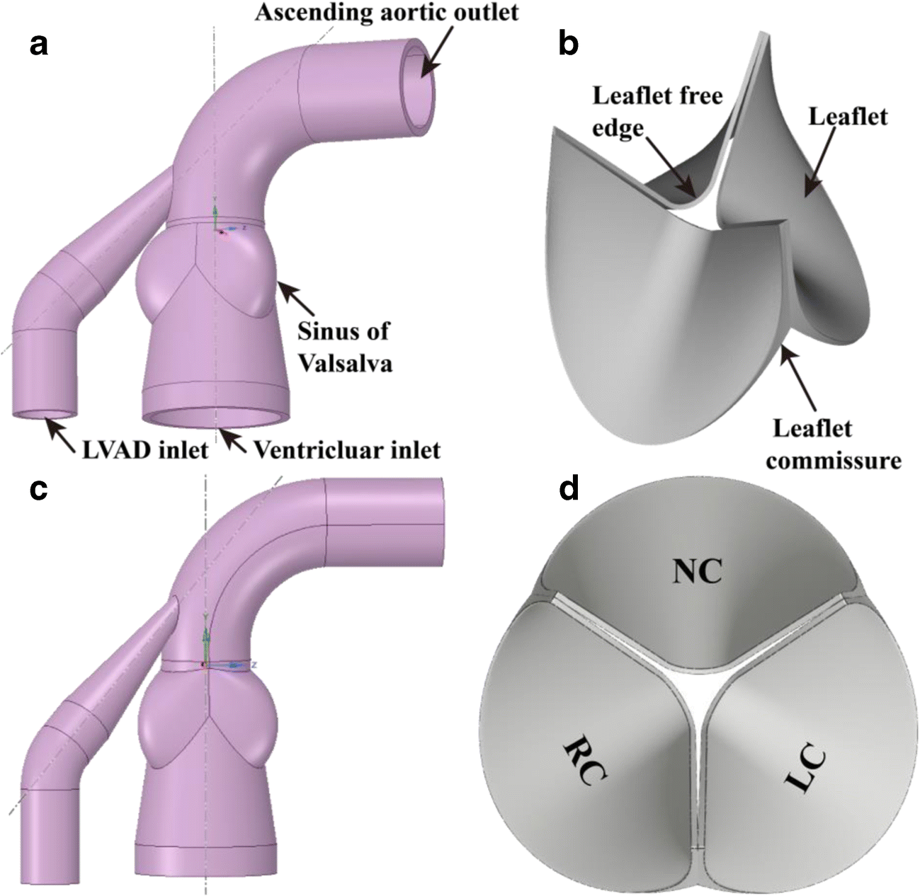 Figure 1 Hemodynamic Effects Of Support Modes Of Lvads On The Aortic Valve Springerlink