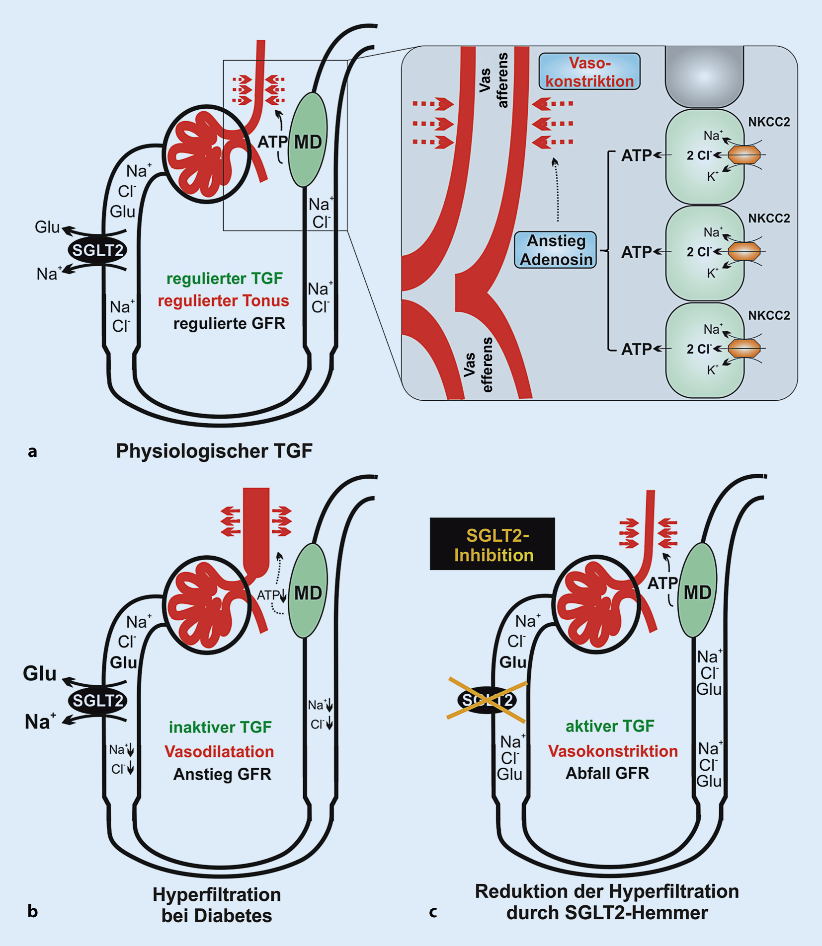 Figure 1 | Beeinflussung der glomerulären Filtrationsrate durch  SGLT2-Inhibitoren | SpringerLink