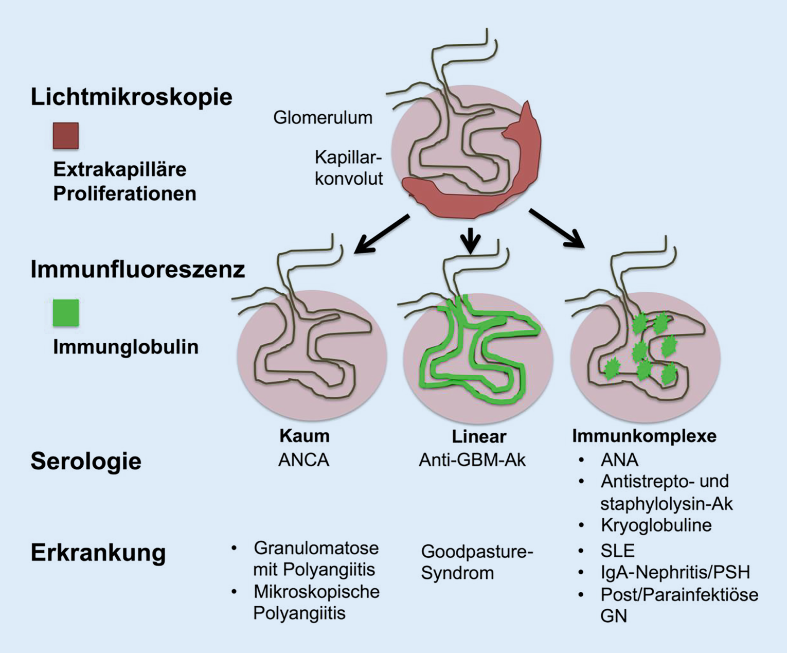 Figure 4 Pulmorenales Syndrom Springerlink