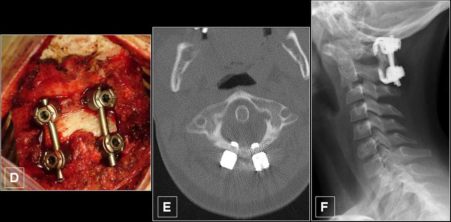 Figure 3 I Traumi Cervicali Del Bambino Springerlink