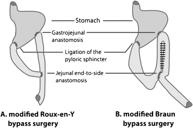 Figure 1 Braun Gastrointestinal Bypass Surgery Exerts Similar Hypoglycemic Effects With Minimal Operation Time And Earlier Functional Recovery Than Roux En Y Bypass In Type 2 Diabetic Rats Springerlink