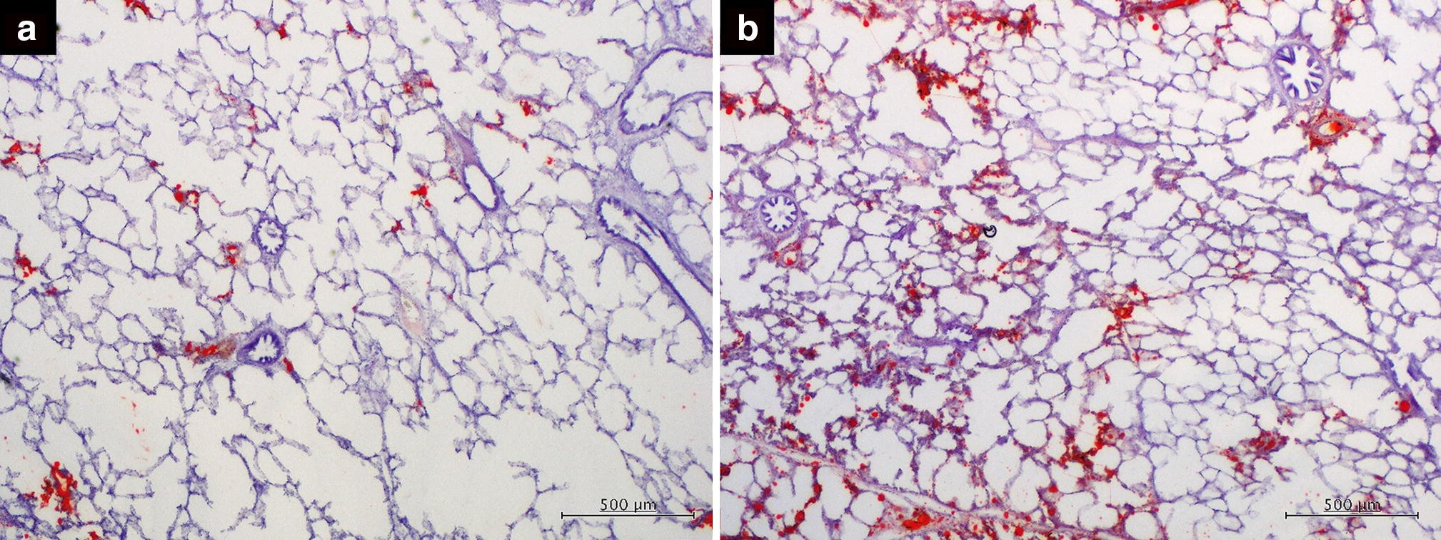 Figure 3 Warm Retrograde Perfusion Can Remove More Fat From Lung Grafts With Fat Embolism In A Porcine Model Springerlink