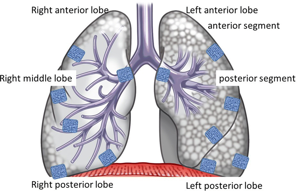 Figure 2 Long Term Effects Of Pleural Defect Repair Using Sheet Materials In A Canine Model Springerlink