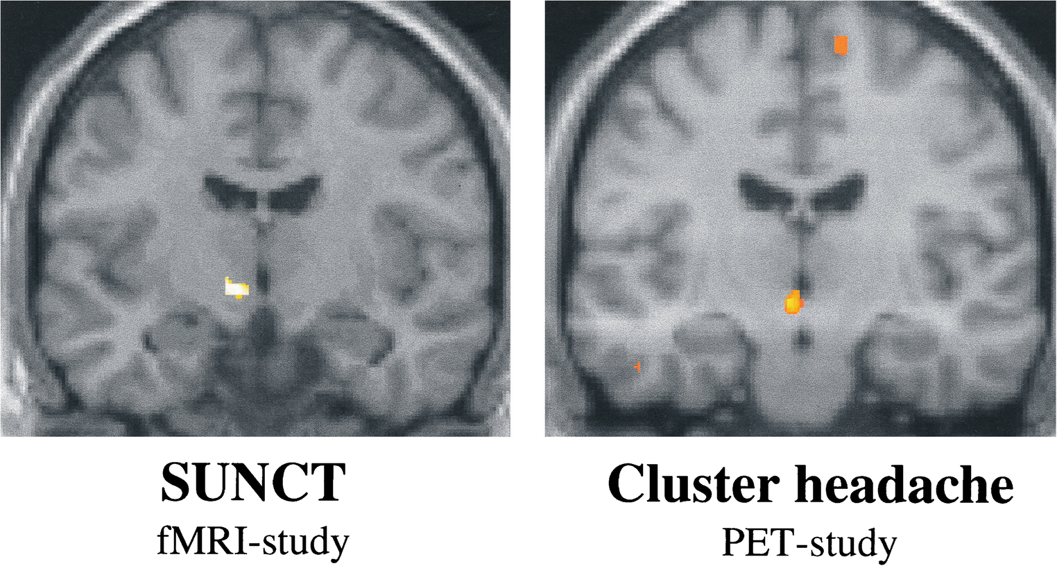 Figure 3 Sunct And Suna An Update And Review Springerlink
