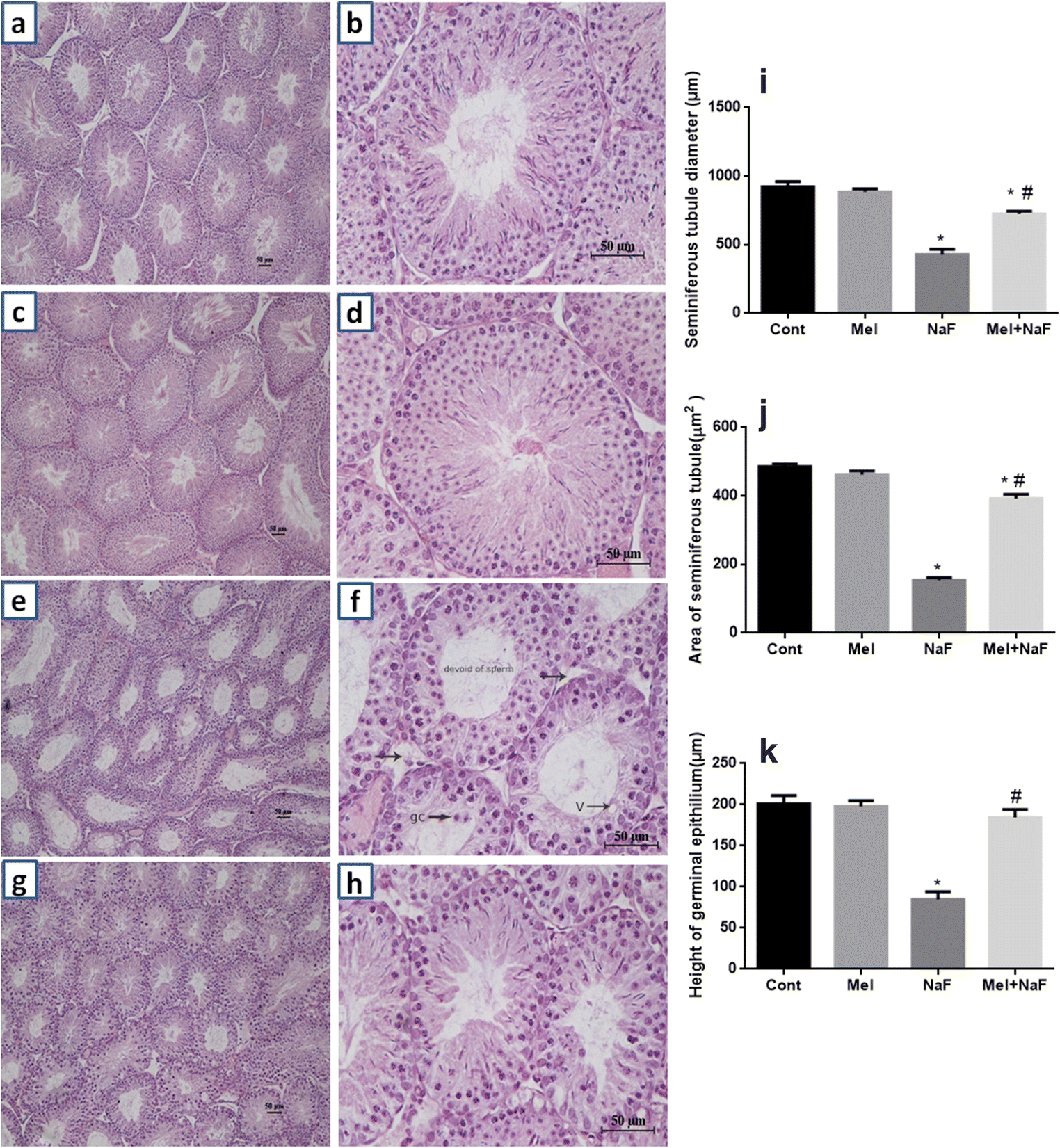 Figure 2 | Fluoride Compromises Testicular Redox Sensor, Gap Junction  Protein, and Metabolic Status: Amelioration by Melatonin | SpringerLink