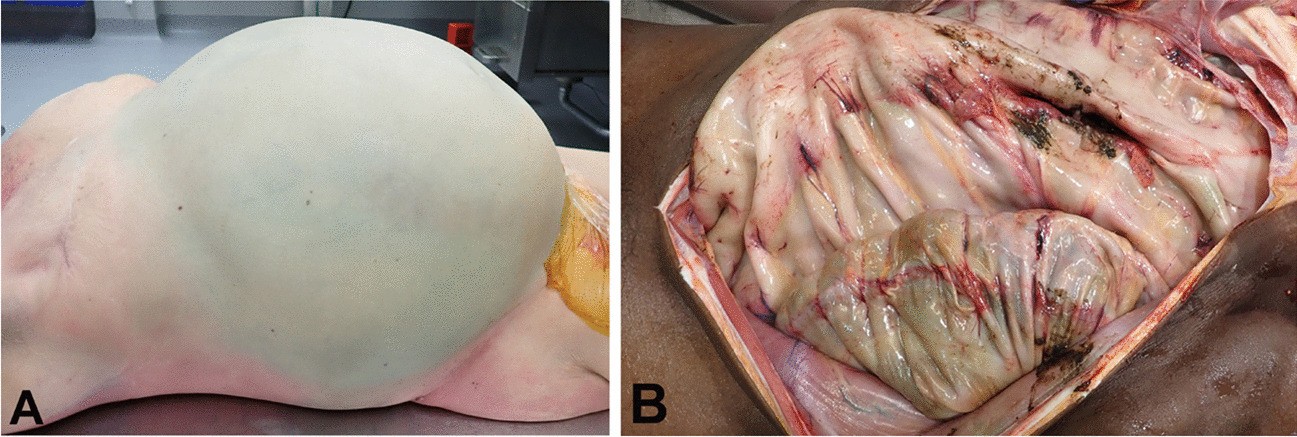 Fig. 6