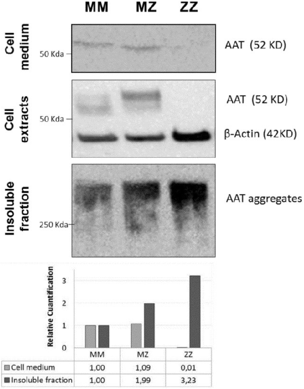 Figure 6 Liver Organoids Reproduce Alpha 1 Antitrypsin Deficiency Related Liver Disease Springerlink Figure 6 Liver Organoids Reproduce Alpha 1 Antitrypsin Deficiency Related Liver Disease Springerlink