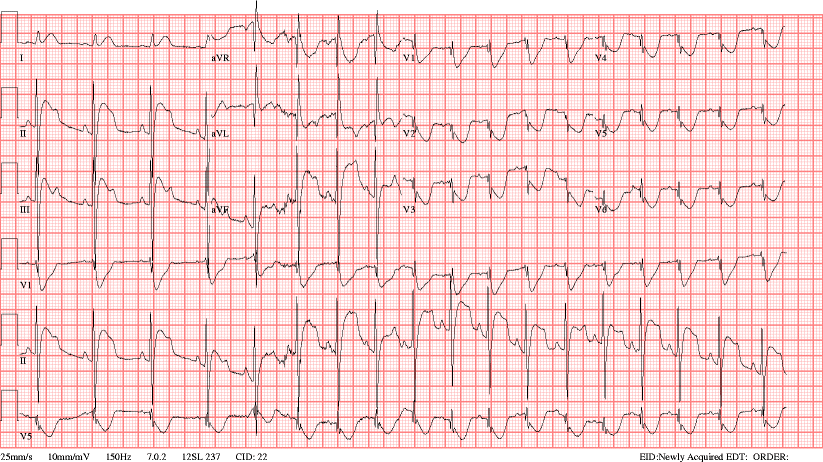 Fig. 3