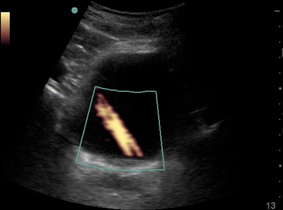 Fig. 1