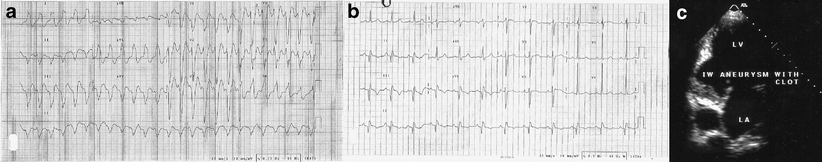 Fig. 1