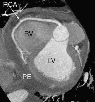 Fig. 4