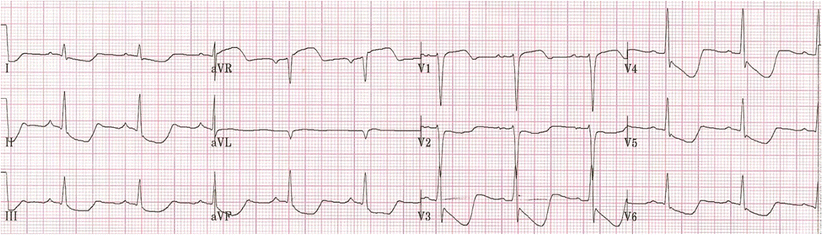 Fig. 1