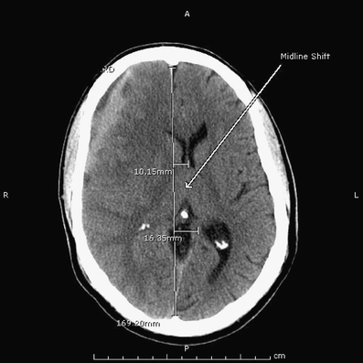 Fig. 3