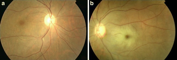 Fig. 1